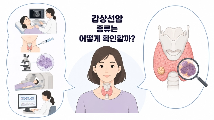 갑상선암 종류