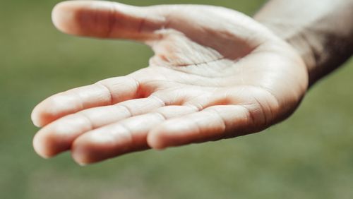 여름철 손 붓는 이유 7가지&amp;#44; 반지가 꽉 낀다면 꼭 확인하세요