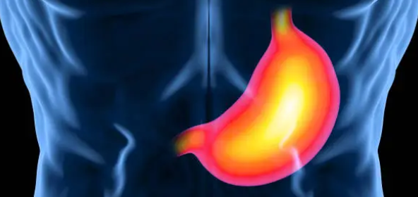 췌장염과 관련된 사진