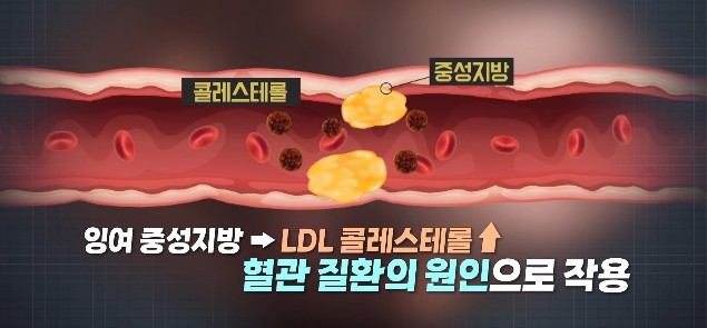 중성지방이란? 중성지방 수치가 뭔가요? 중성지방 낮추는법&#44; LDL 콜레스테롤 수치&#44; HDL 콜레스테롤 수치