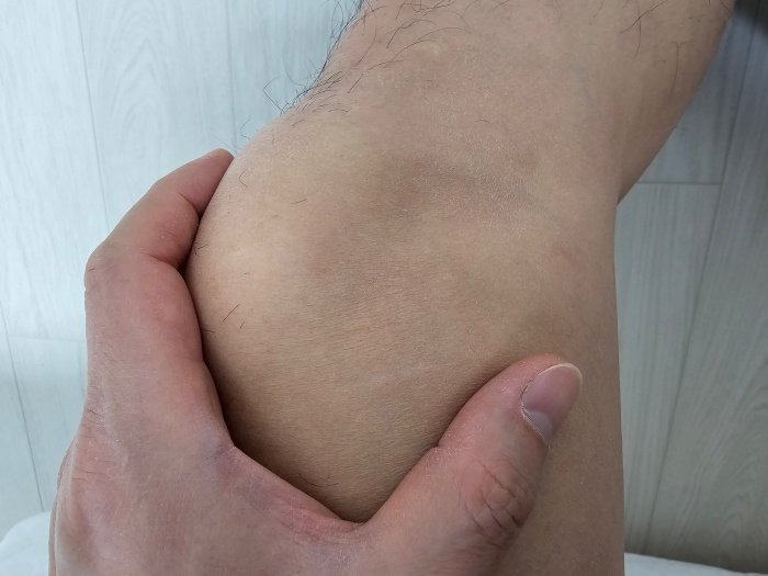 통증이-느껴지는-무릎