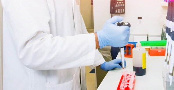 혈액을-검사하는-사람