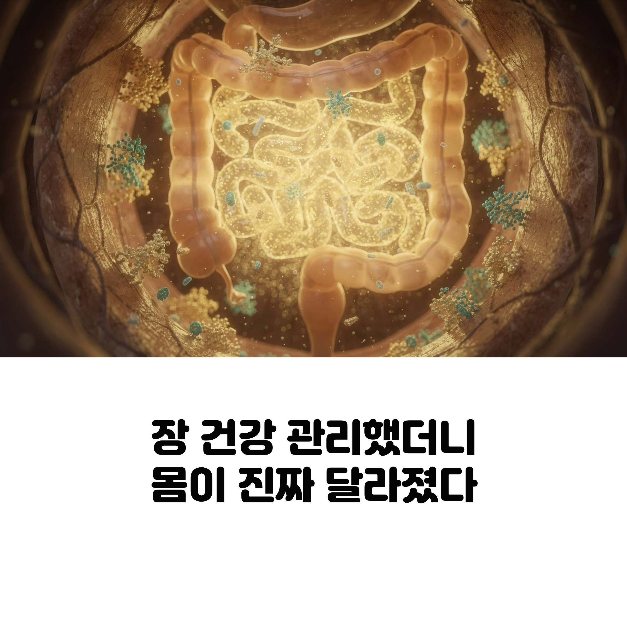 장 건강 관리