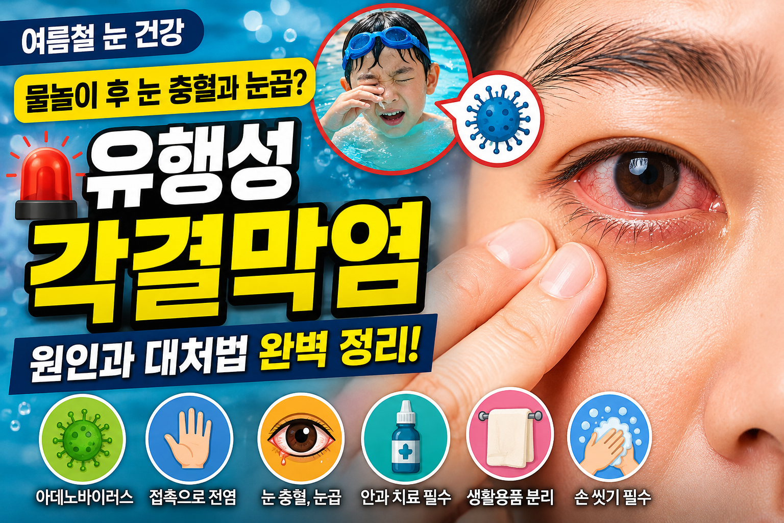 유행성 각결막염 원인과 대처법 완벽 정리