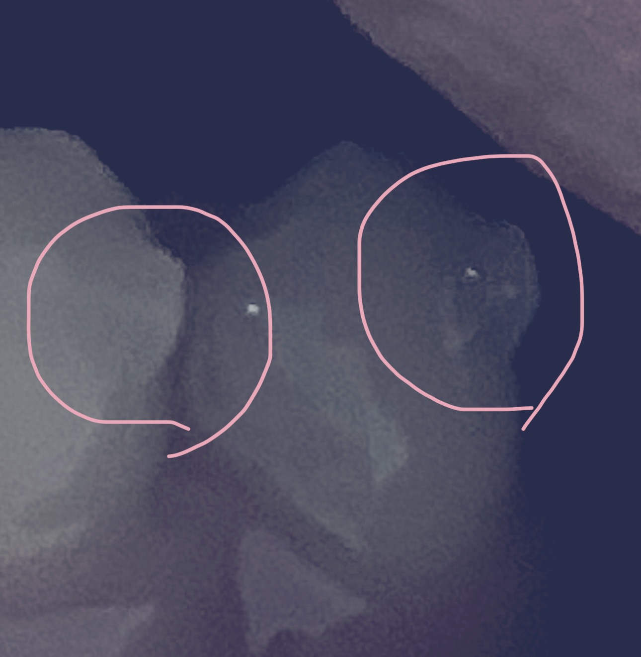 어태치먼트의-모습