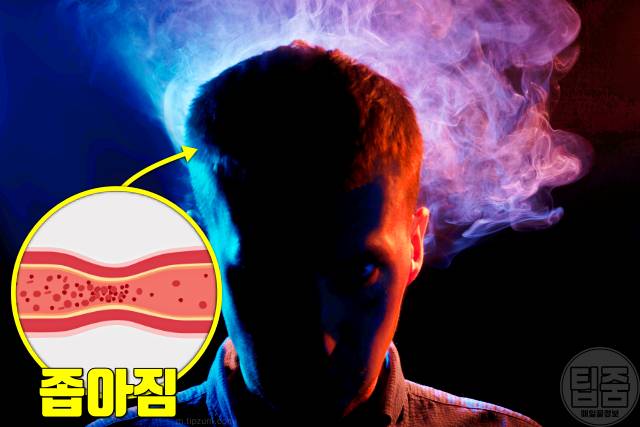 뇌에 피가 부족할때 증상 피가부족한증상 뇌혈류장애 머리가 멍