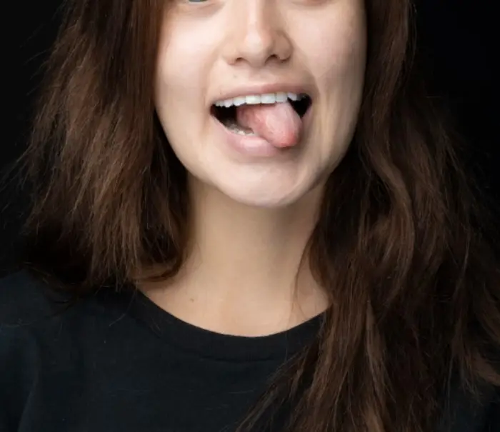 알보칠 사용법