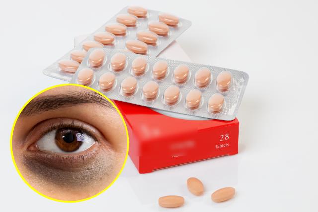 눈밑 지방 다크서클 원인 안좋은약