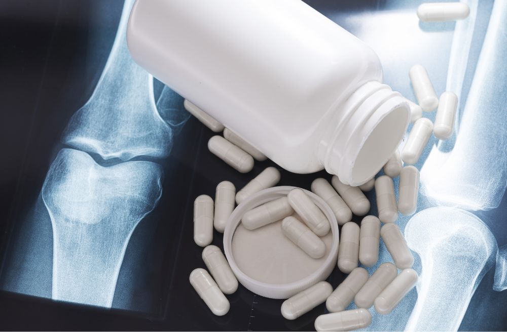 글루코사민 콘드로이틴