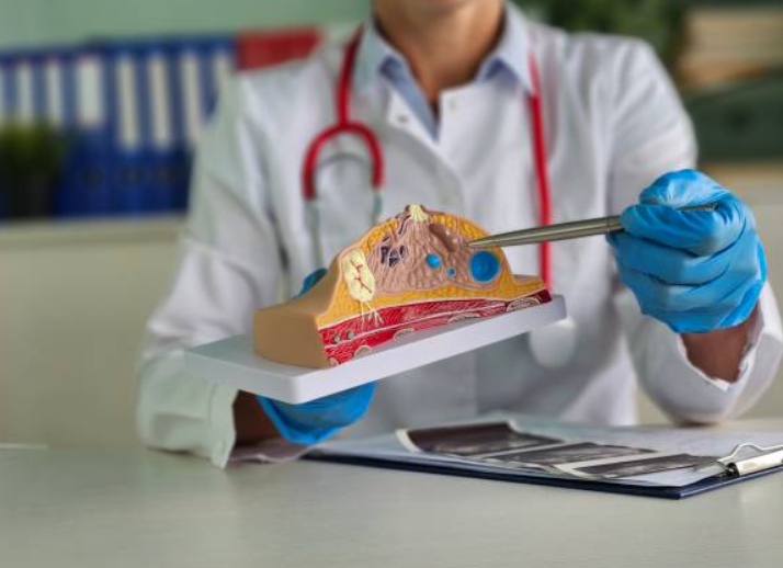 유방암과 관련된 사진1