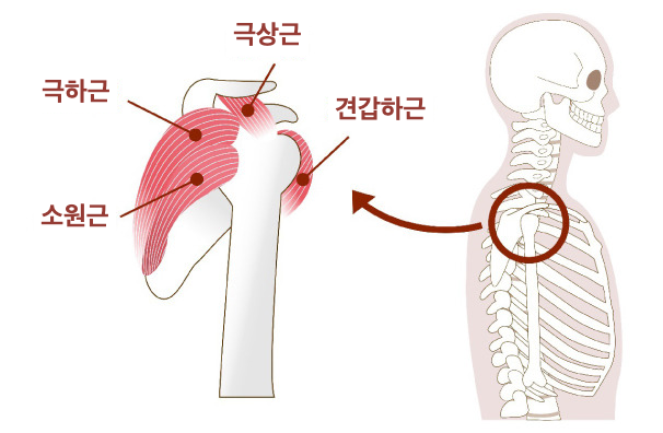 회전근개파열 증상 어깨 통증의 원인