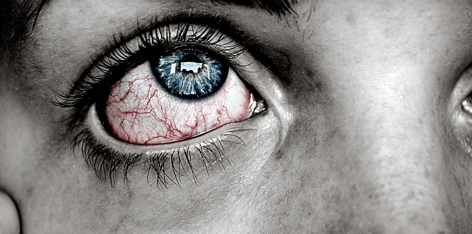 눈이 아픈 사람의 눈동자 사진 - 2