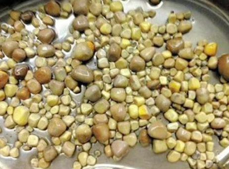 신장 결석 증상