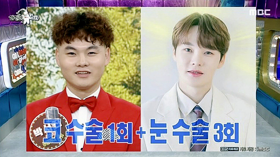 박서진 성형 내용 비용