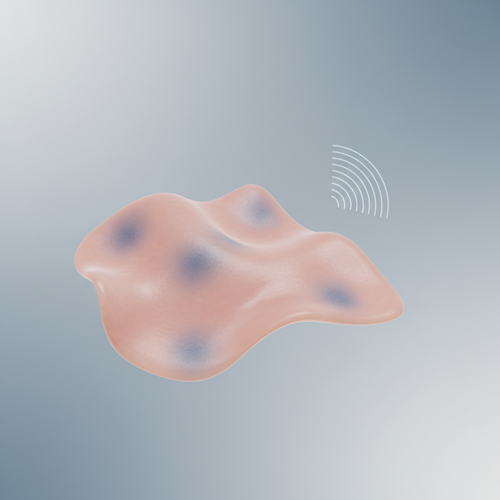 "나도 사면발이?" 의심해야 할 증상과 특징