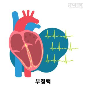 기립성 어지럼증