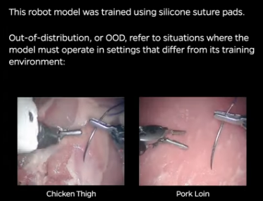 surgery
