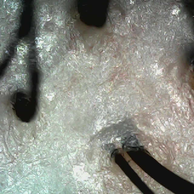 탈모 극복 프로젝트 - 뒷머리 두피 모습이다.