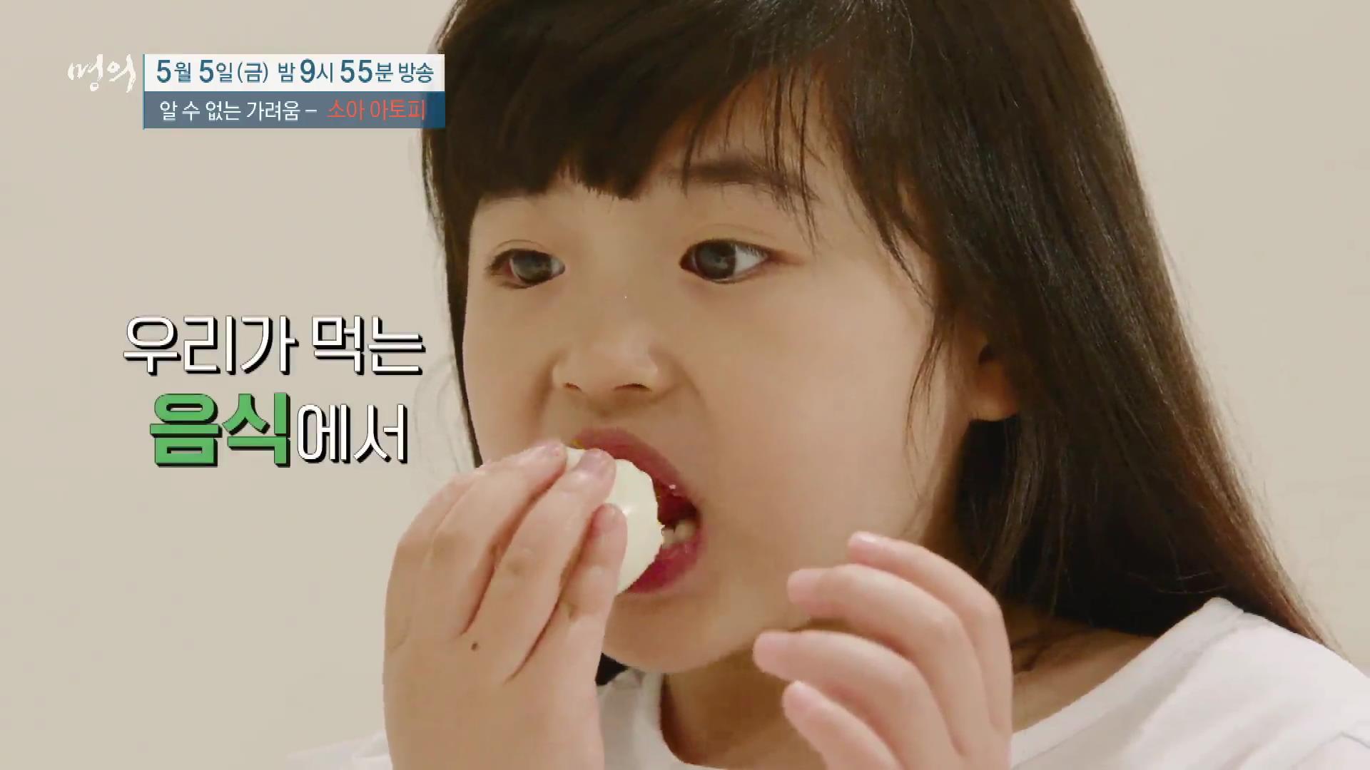 명의 어린이 소아 아토피 피부염 스테로이드 효과 및 부작용 완치 치료제 신약 비용 방법