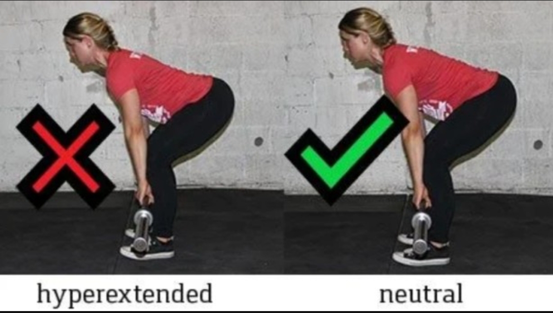 데드리프트 과신전 설명 사진