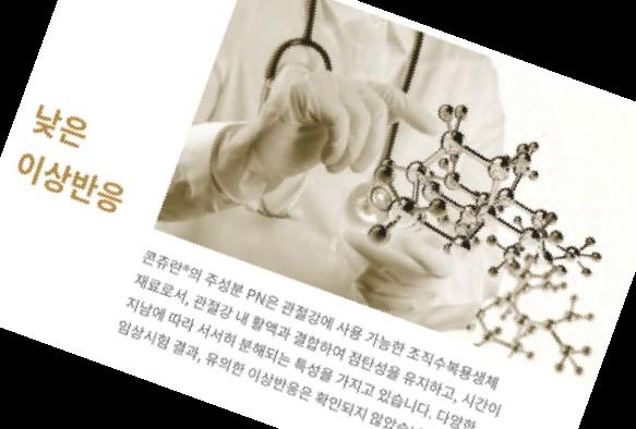 콘쥬란 주사 가격