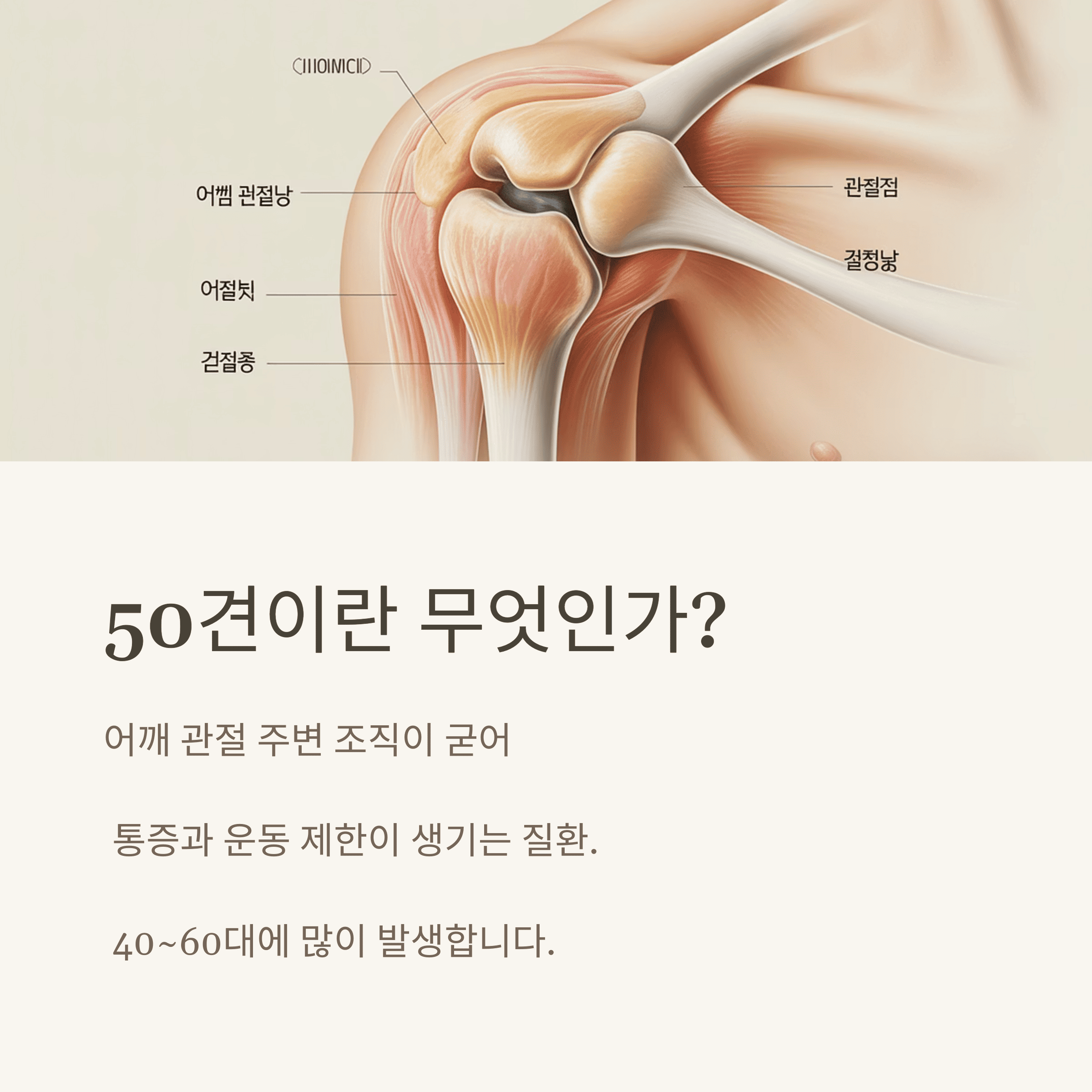 50견을 다스리는 자연요법