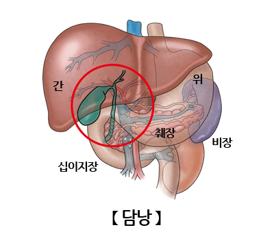 담낭암