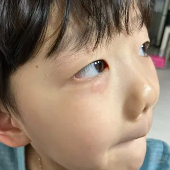 고양이 털 알레르기 완화 방법과 생활 관리 팁_23
