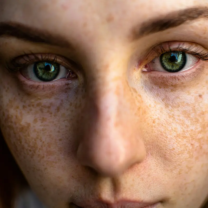 중년 여성 피부노화에 콜라겐 효과 있나요? 잡티까지 개선될까