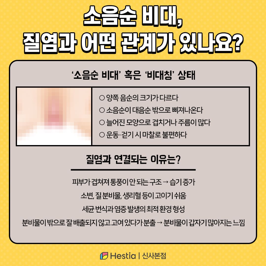 소음순 비대, 질염과 어떤 관계가 있나요?
