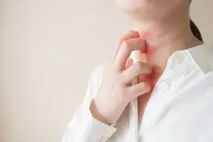 가려움