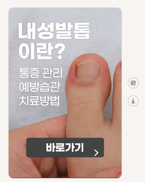 내성발톱이란? (통증관리, 예방습관, 치료방법)