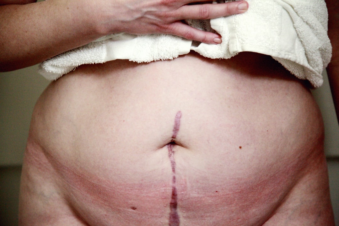 Abdomen.