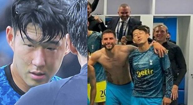 얼굴에-부상을-입은-손흥민선수