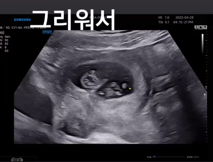 이재은 임신