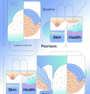 피부가려움증의 원인