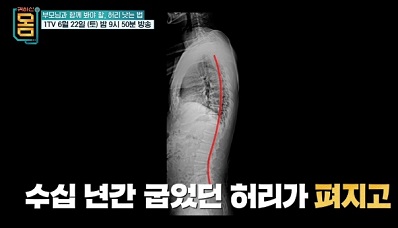 허리펴짐