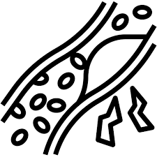 나쁜콜레스테롤 낮추는 방법