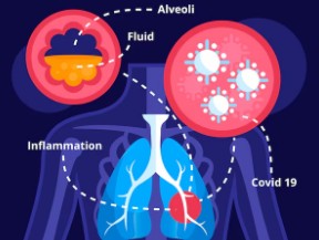폐렴-초기-증상과-원인-3
