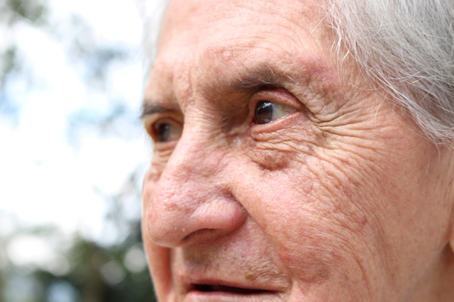 알츠하이머 치매 치료 정보와 예방