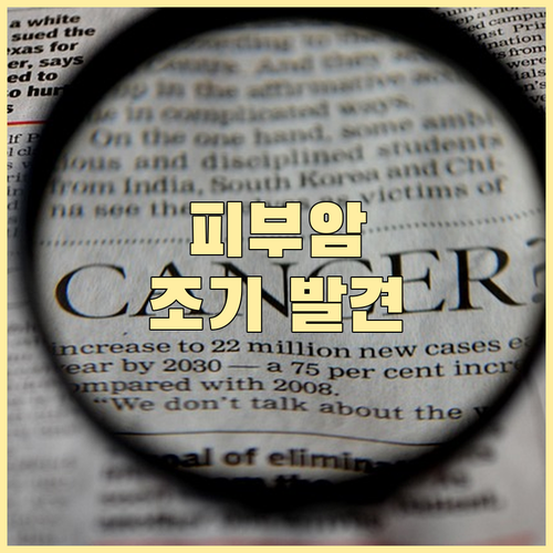 피부암 조기 발견의 중요성: 종류, ..