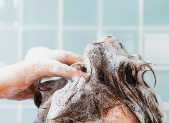 비듬-제거-방법