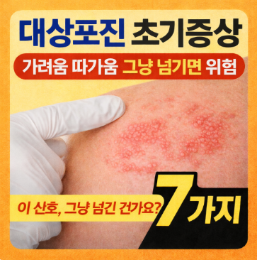 대상포진 초기증상