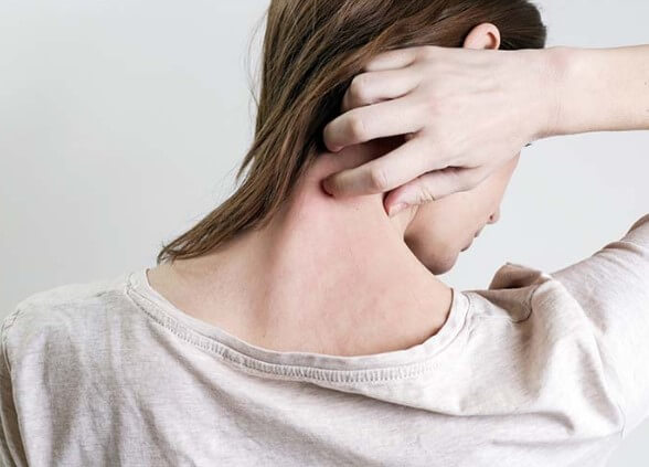 대상포진 초기증상 대상포진 조기치료 대상포진 초기증상 및 조기치료