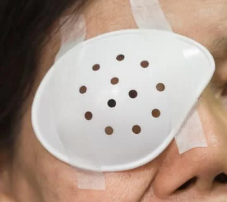 백내장 수술 후 시력회복 기간 주의사항 정리