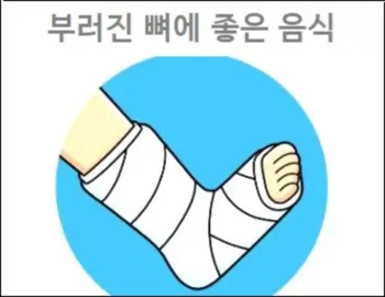부러진 뼈에 좋은 음식