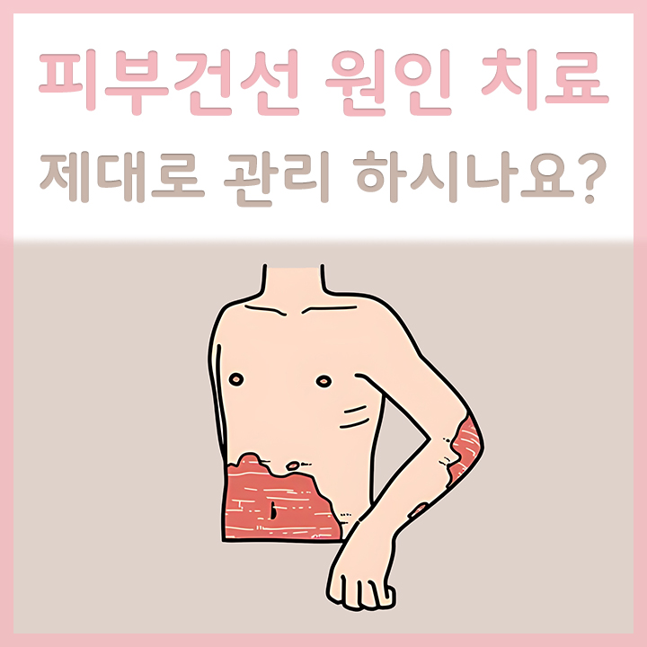 피부건선이-심한-남성