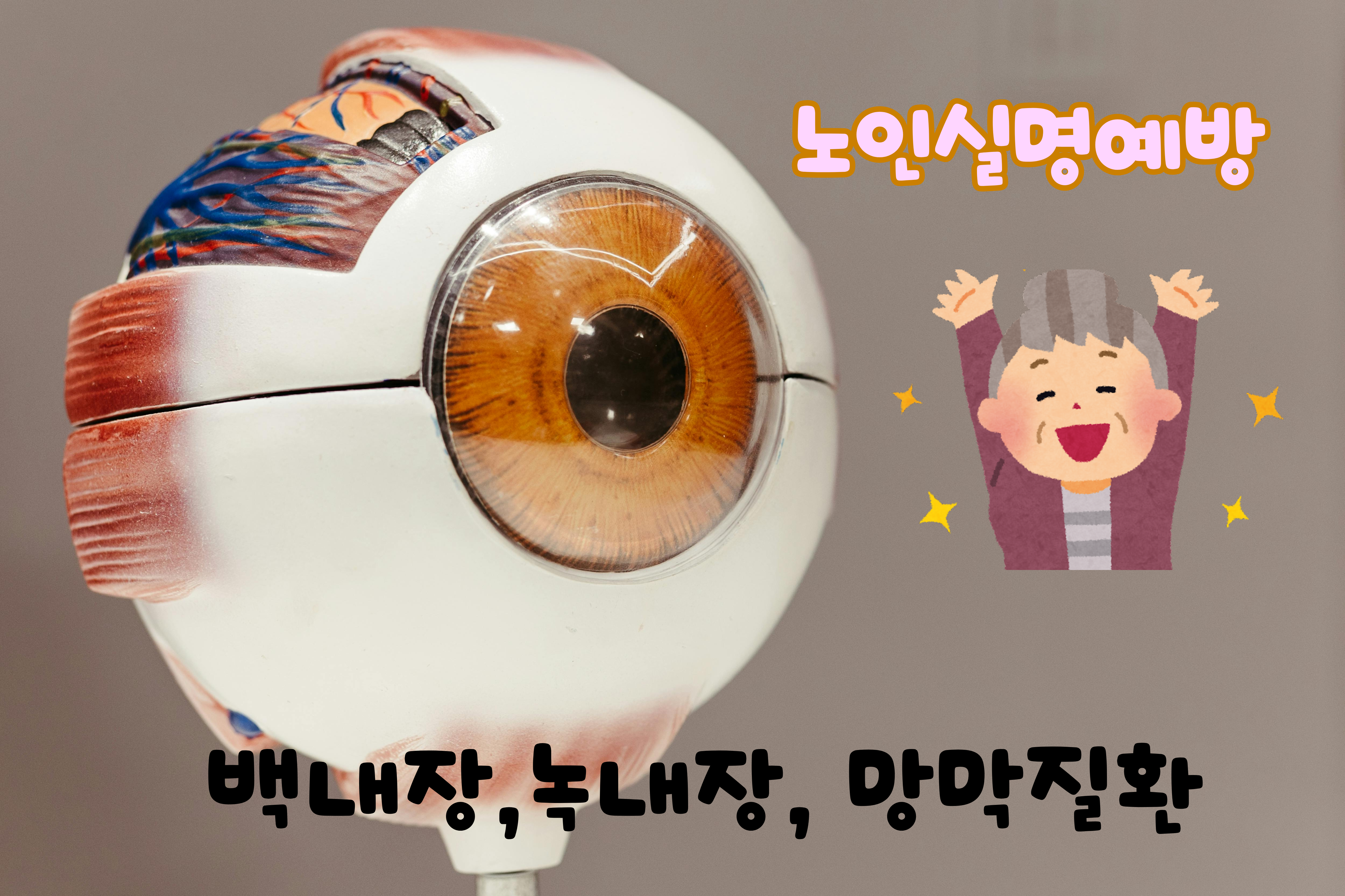 백내장, 녹내장, 망막질환