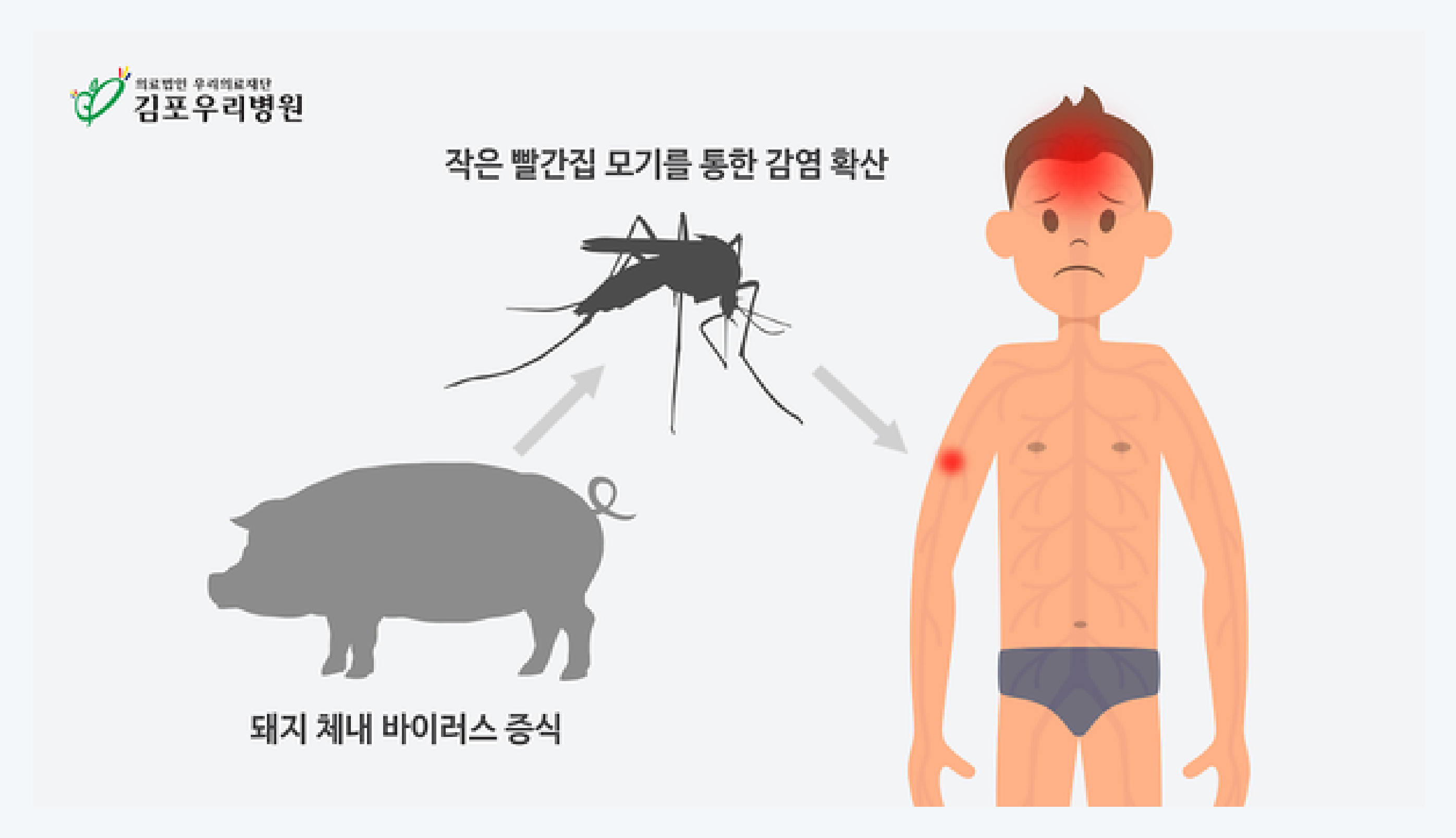 일본뇌염