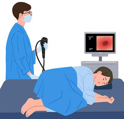 대장내시경 하는 모습